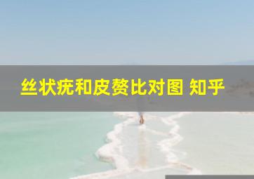 丝状疣和皮赘比对图 知乎